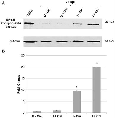 Coxiella burnetii Employs the Dot/Icm Type IV Secretion System to Modulate Host NF-κB/RelA Activation